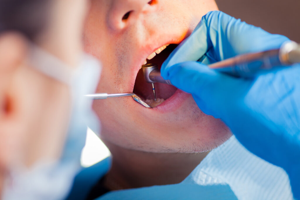 doctor examining a tooth that needs extraction
