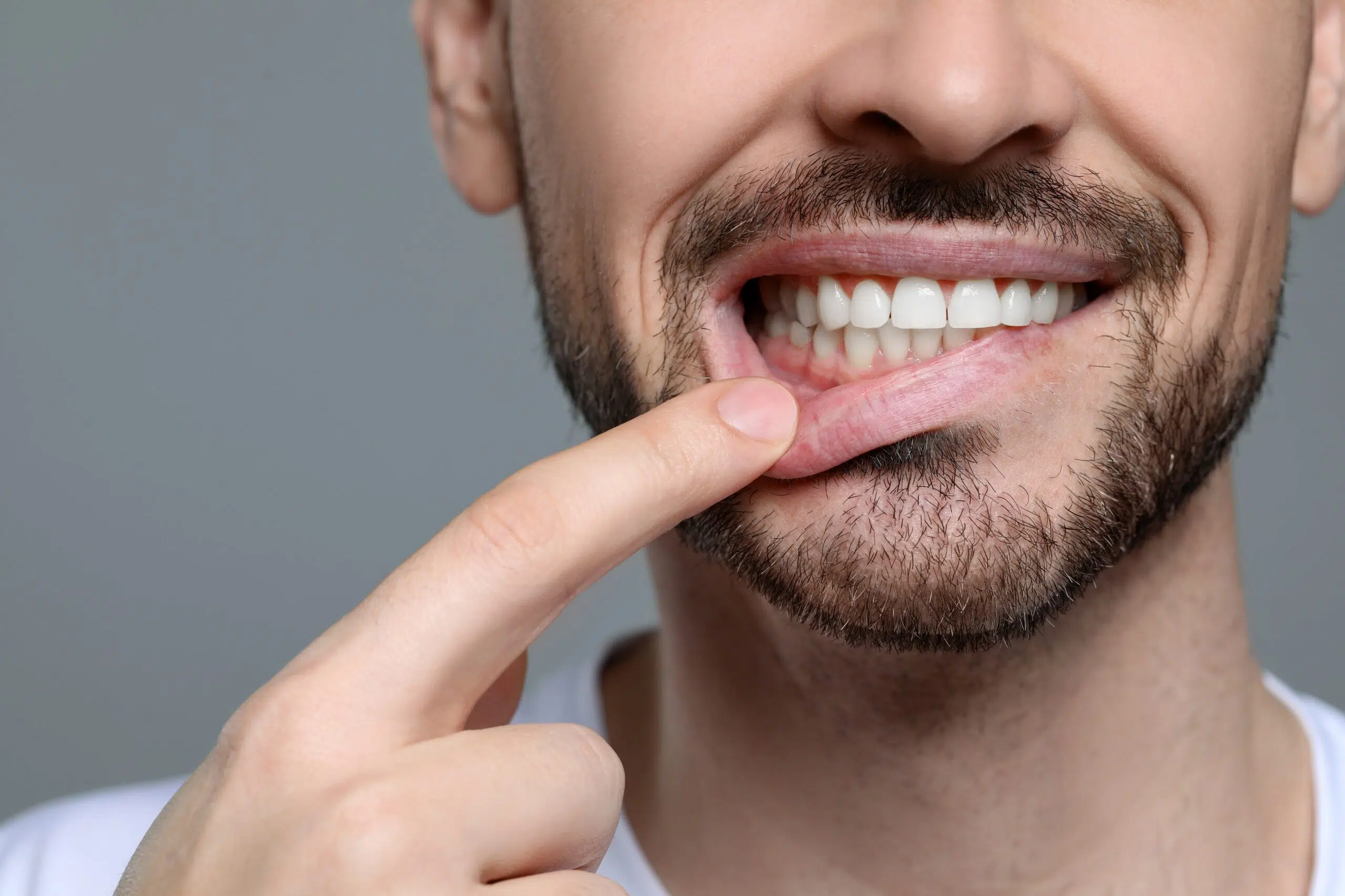 closeup of a man pulling down his lip exposing healthy gums