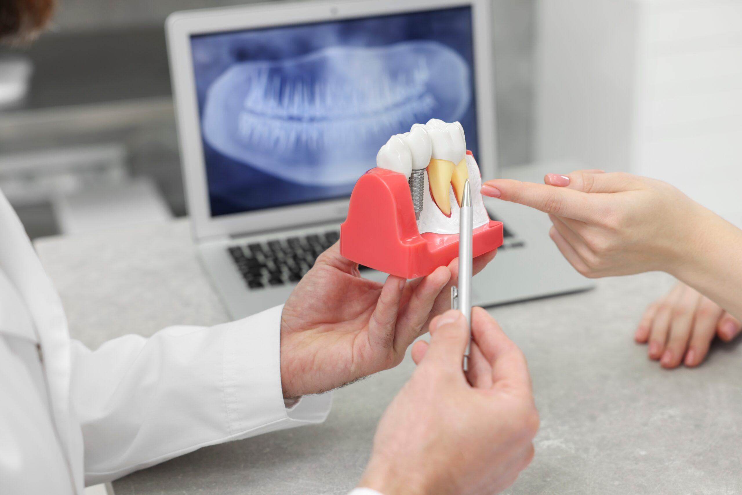 doctor showing a dental patient an implant model